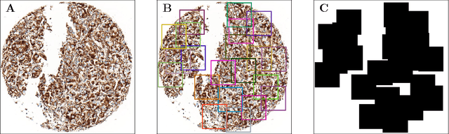 Figure 4 for Mitochondria-based Renal Cell Carcinoma Subtyping: Learning from Deep vs. Flat Feature Representations
