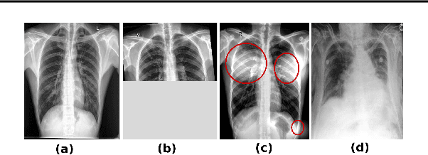 Figure 4 for Lung Segmentation from Chest X-rays using Variational Data Imputation