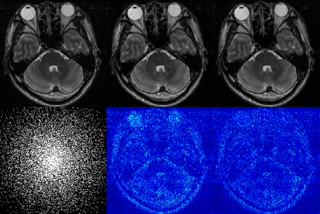 Figure 3 for DeepcomplexMRI: Exploiting deep residual network for fast parallel MR imaging with complex convolution