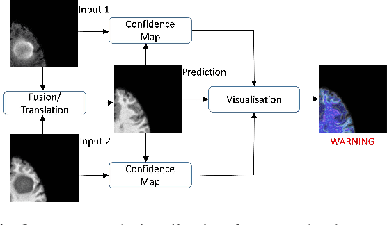 Figure 1 for Visualisation of Medical Image Fusion and Translation for Accurate Diagnosis of High Grade Gliomas