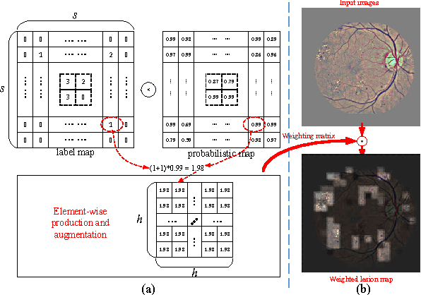Figure 3 for Lesion detection and Grading of Diabetic Retinopathy via Two-stages Deep Convolutional Neural Networks