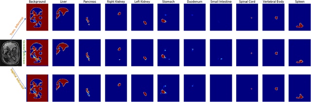 Figure 3 for Fully Automated Multi-Organ Segmentation in Abdominal Magnetic Resonance Imaging with Deep Neural Networks