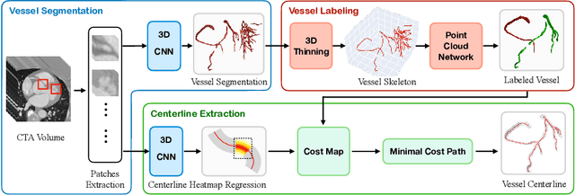 Figure 1 for Learning Hybrid Representations for Automatic 3D Vessel Centerline Extraction