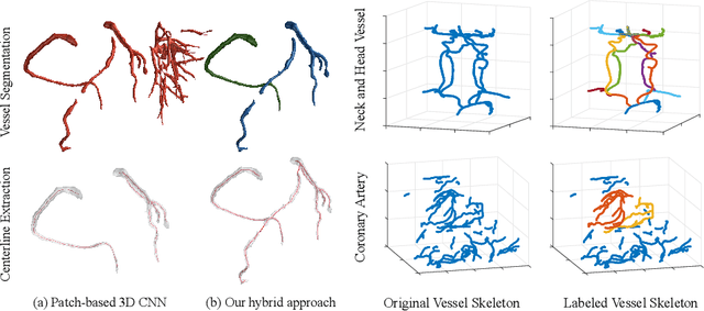 Figure 3 for Learning Hybrid Representations for Automatic 3D Vessel Centerline Extraction