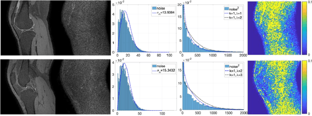 Figure 1 for Denoising of Three-Dimensional Fast Spin Echo Magnetic Resonance Images of Knee Joints using Spatial-Variant Noise-Relevant Residual Learning of Convolution Neural Network