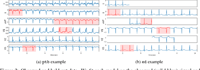 Figure 2 for A Probabilistic Model of Cardiac Physiology and Electrocardiograms