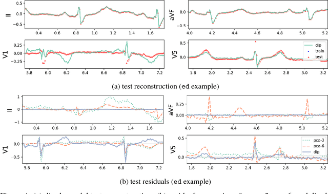 Figure 4 for A Probabilistic Model of Cardiac Physiology and Electrocardiograms