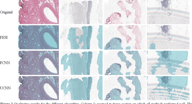Figure 4 for Comparison of Different Methods for Tissue Segmentation in Histopathological Whole-Slide Images