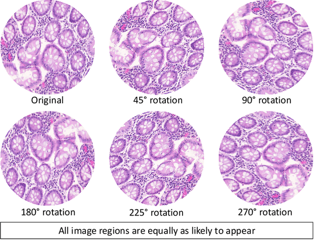 Figure 1 for Dense Steerable Filter CNNs for Exploiting Rotational Symmetry in Histology Images