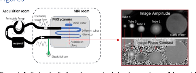 Figure 1 for Accuracy of Real-Time Echo-Planar Imaging Phase Contrast MRI