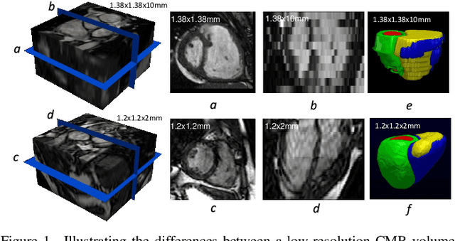 Figure 1 for Automatic 3D bi-ventricular segmentation of cardiac images by a shape-constrained multi-task deep learning approach