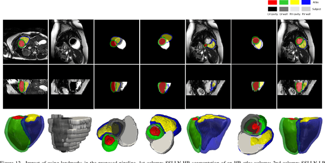 Figure 4 for Automatic 3D bi-ventricular segmentation of cardiac images by a shape-constrained multi-task deep learning approach