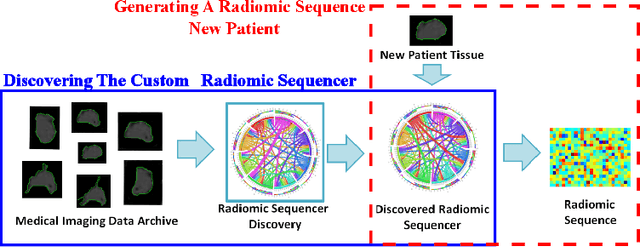 Figure 1 for Discovery Radiomics via StochasticNet Sequencers for Cancer Detection
