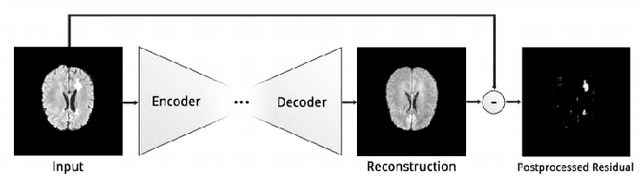 Figure 4 for Deep Learning Based Brain Tumor Segmentation: A Survey