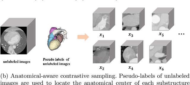 Figure 3 for Self-Ensembling Contrastive Learning for Semi-Supervised Medical Image Segmentation