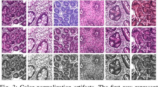 Figure 3 for Hierarchical Deep Convolutional Neural Networks for Multi-category Diagnosis of Gastrointestinal Disorders on Histopathological Images