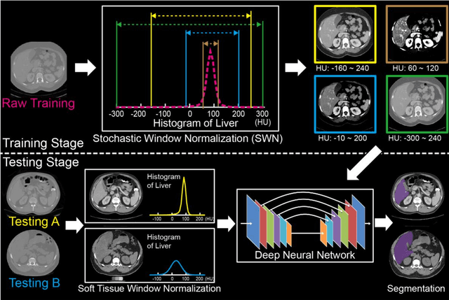 Figure 3 for Stochastic tissue window normalization of deep learning on computed tomography