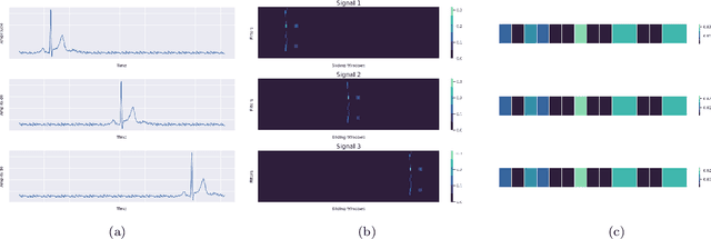 Figure 1 for RamanNet: A generalized neural network architecture for Raman Spectrum Analysis
