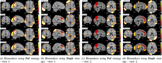 Figure 2 for Multi-site fMRI Analysis Using Privacy-preserving Federated Learning and Domain Adaptation: ABIDE Results
