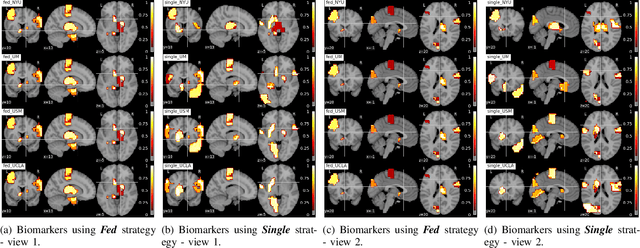 Figure 3 for Multi-site fMRI Analysis Using Privacy-preserving Federated Learning and Domain Adaptation: ABIDE Results
