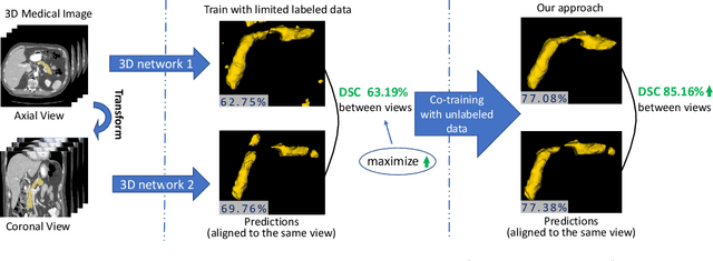 Figure 1 for Uncertainty-aware multi-view co-training for semi-supervised medical image segmentation and domain adaptation
