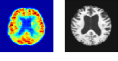 Figure 1 for MRI to FDG-PET: Cross-Modal Synthesis Using 3D U-Net For Multi-Modal Alzheimer's Classification