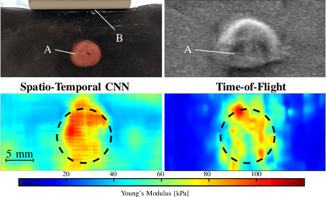 Figure 3 for Ultrasound Shear Wave Elasticity Imaging with Spatio-Temporal Deep Learning