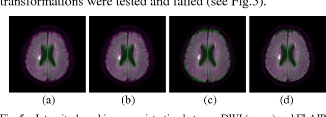 Figure 3 for Automatic Stroke Lesions Segmentation in Diffusion-Weighted MRI