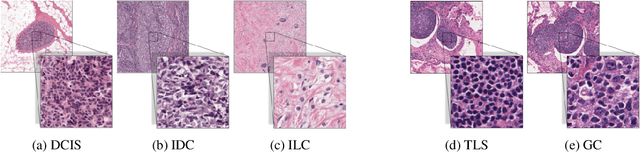 Figure 1 for HookNet: multi-resolution convolutional neural networks for semantic segmentation in histopathology whole-slide images