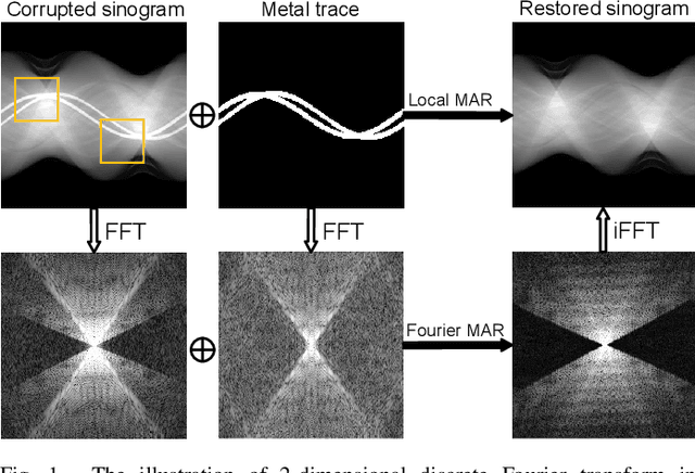Figure 1 for FD-MAR: Fourier Dual-domain Network for CT Metal Artifact Reduction