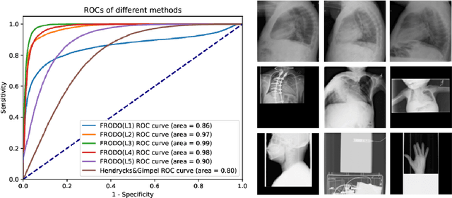 Figure 1 for FRODO: Free rejection of out-of-distribution samples: application to chest x-ray analysis