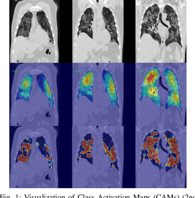 Figure 1 for Dense Regression Activation Maps For Lesion Segmentation in CT scans of COVID-19 patients