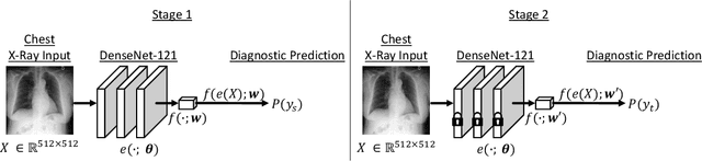 Figure 1 for Deep Learning Applied to Chest X-Rays: Exploiting and Preventing Shortcuts