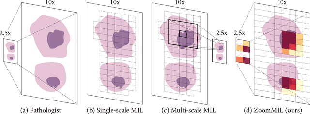 Figure 1 for Differentiable Zooming for Multiple Instance Learning on Whole-Slide Images