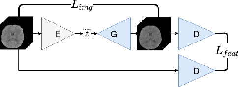 Figure 2 for Unsupervised 3D Brain Anomaly Detection