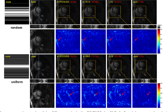 Figure 2 for An Unsupervised Deep Learning Method for Parallel Cardiac MRI via Time-Interleaved Sampling