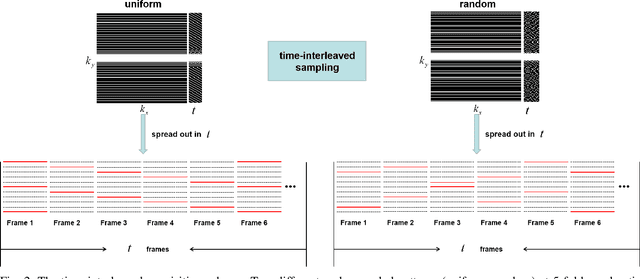 Figure 3 for An Unsupervised Deep Learning Method for Parallel Cardiac MRI via Time-Interleaved Sampling