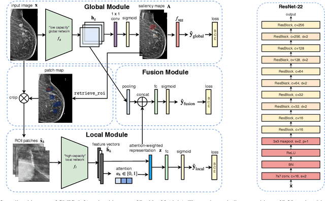 Figure 3 for An interpretable classifier for high-resolution breast cancer screening images utilizing weakly supervised localization