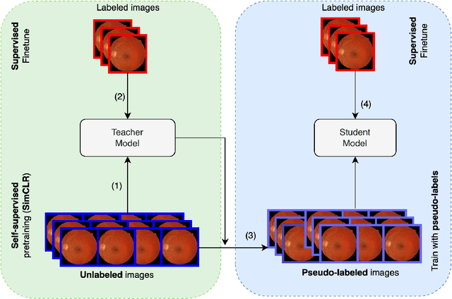 Figure 1 for Deep Semi-Supervised and Self-Supervised Learning for Diabetic Retinopathy Detection