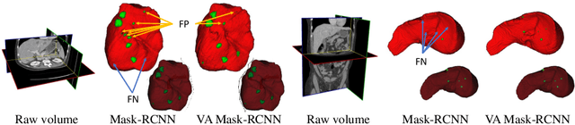 Figure 1 for Volumetric Attention for 3D Medical Image Segmentation and Detection