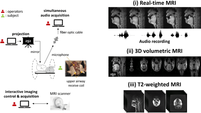 Figure 2 for A multispeaker dataset of raw and reconstructed speech production real-time MRI video and 3D volumetric images