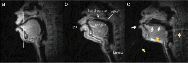 Figure 4 for A multispeaker dataset of raw and reconstructed speech production real-time MRI video and 3D volumetric images
