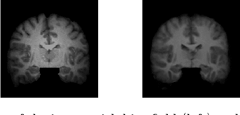 Figure 1 for A Statistical Model for Simultaneous Template Estimation, Bias Correction, and Registration of 3D Brain Images