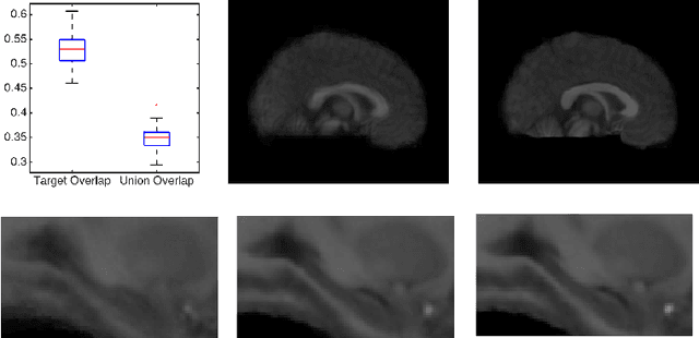 Figure 2 for A Statistical Model for Simultaneous Template Estimation, Bias Correction, and Registration of 3D Brain Images