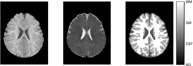 Figure 1 for Global Deep Learning Methods for Multimodality Isointense Infant Brain Image Segmentation