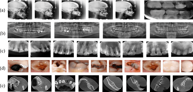 Figure 1 for CTooth+: A Large-scale Dental Cone Beam Computed Tomography Dataset and Benchmark for Tooth Volume Segmentation