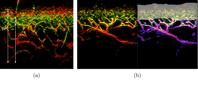 Figure 1 for A distance-based loss for smooth and continuous skin layer segmentation in optoacoustic images