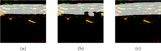 Figure 4 for A distance-based loss for smooth and continuous skin layer segmentation in optoacoustic images
