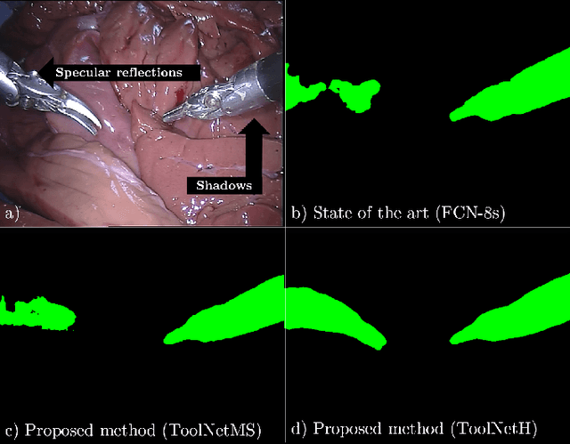 Figure 1 for ToolNet: Holistically-Nested Real-Time Segmentation of Robotic Surgical Tools