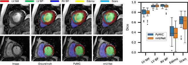 Figure 3 for PyMIC: A deep learning toolkit for annotation-efficient medical image segmentation